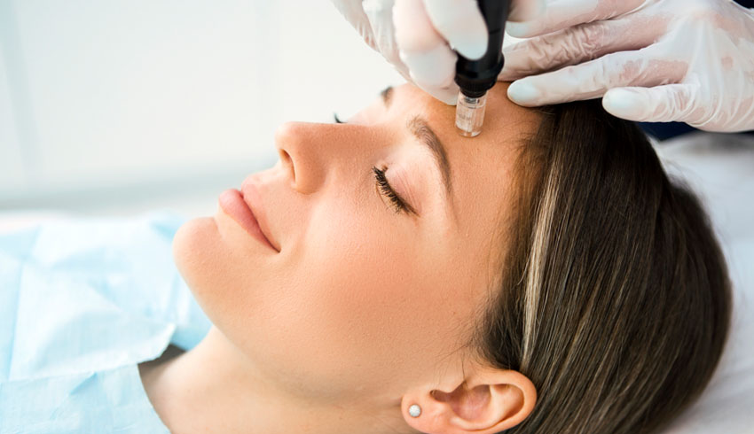 I Tried Microneedling For Texture & Fine Lines: Here&rsquo;s What Happened 